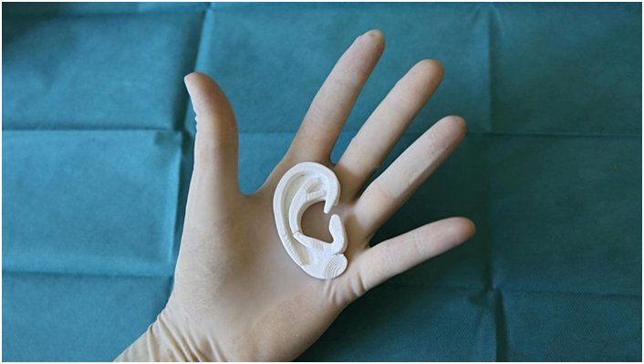 Ear-y Developments In 3D Printing And R&D