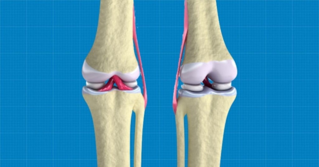 Bioprinting Cartilage Tissue To Help Knees Function Again