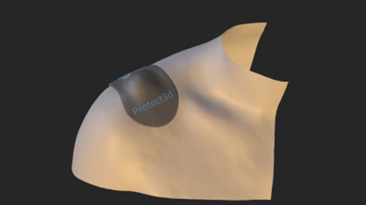 The NFL’s Concussion Protocol, Traumatic Brain Injuries, and 3D