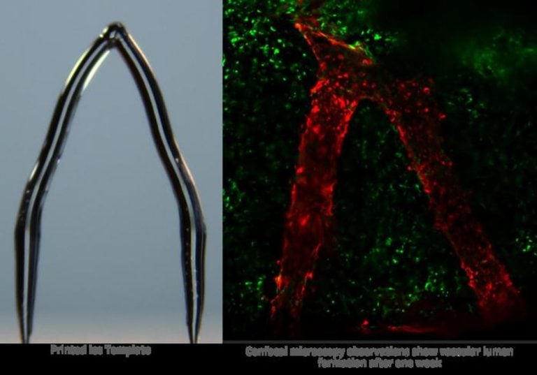 Ice 3D Printing: A Cool New Approach to Developing Artificial Blood Vessels for Organ Bioprinting