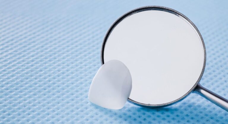 BMF’s UltraThineer Earns FDA Clearance for Cosmetic Veneers