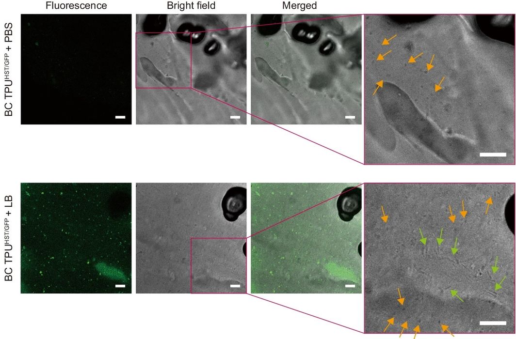 Breaking Down Plastics with Bacteria: Could This Work For 3D Printing?