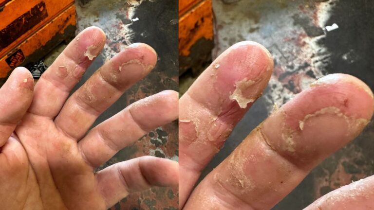 Reddit Thread Reveals Alarming Ignorance of Resin 3D Printer Safety Protocols