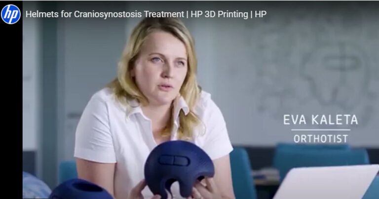 From Scan to Solution: Invent Medical’s Blueprint for Mass Personalization