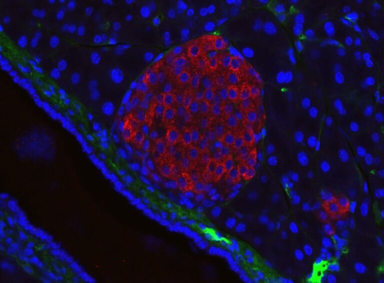 New Bioink Enables 3D Printing of Insulin-Producing Cells for Diabetes Therapy