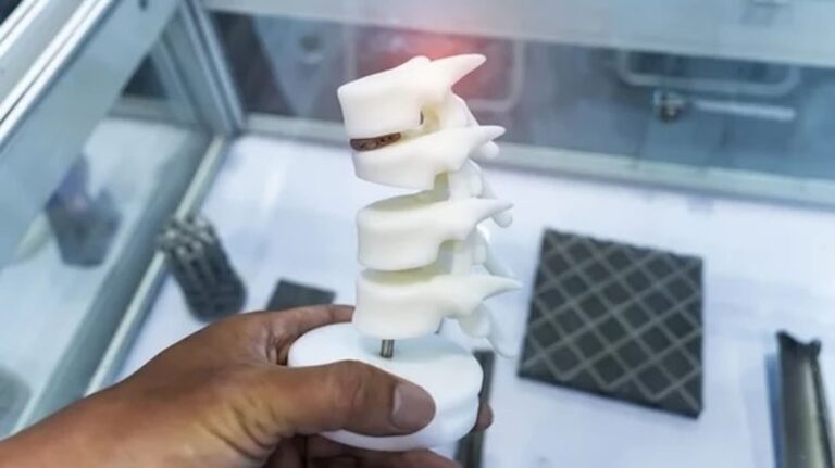 In-House 3D Printing in Radiology Signals Erosion of Market for High-Cost Commercial Systems
