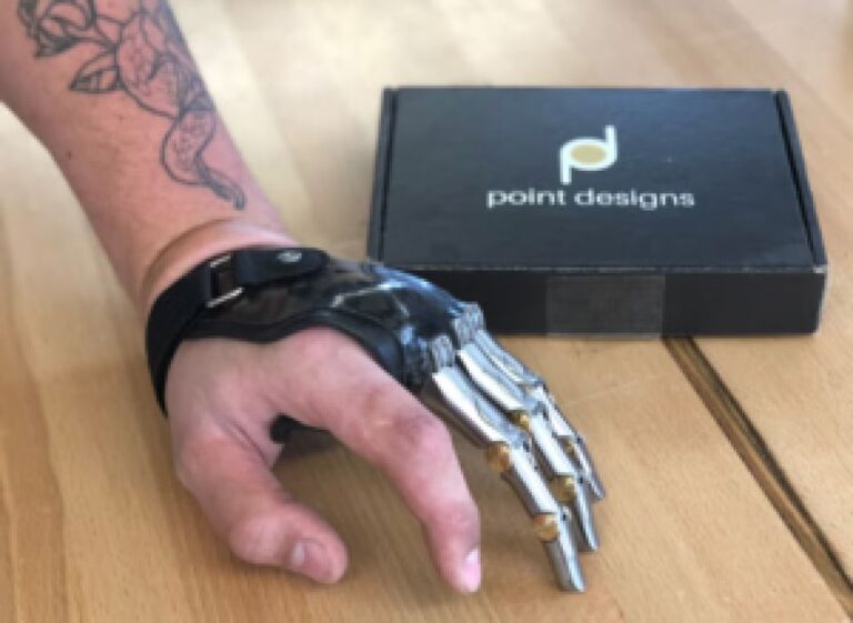 How 3D Printing Innovation in Prosthetics Led from CU Labs to Hanger’s Acquisition of Point Designs