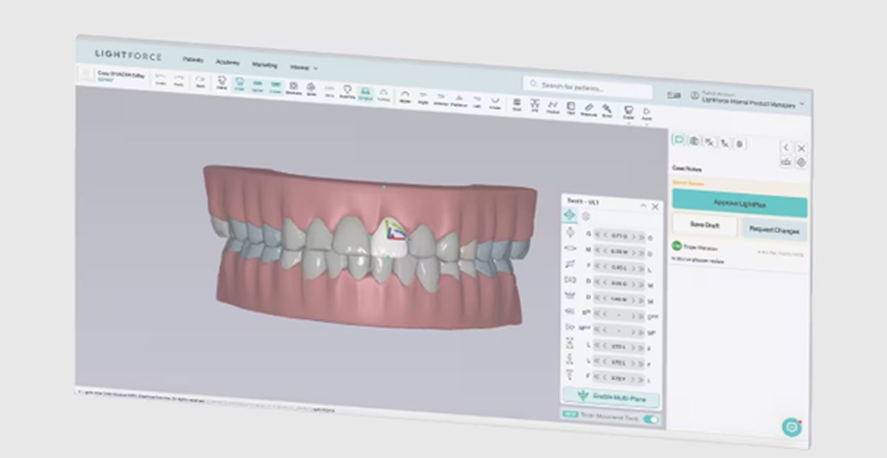Generative Braces Move Into Metal: An Interview with LightForce’s James ...
