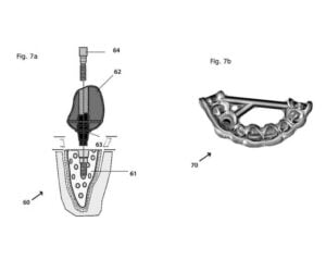 Trinckle Patents User Guided 3D Printing Configuration