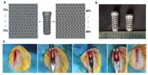 Study Probes 3D Printed Gyroid Implants For Bone