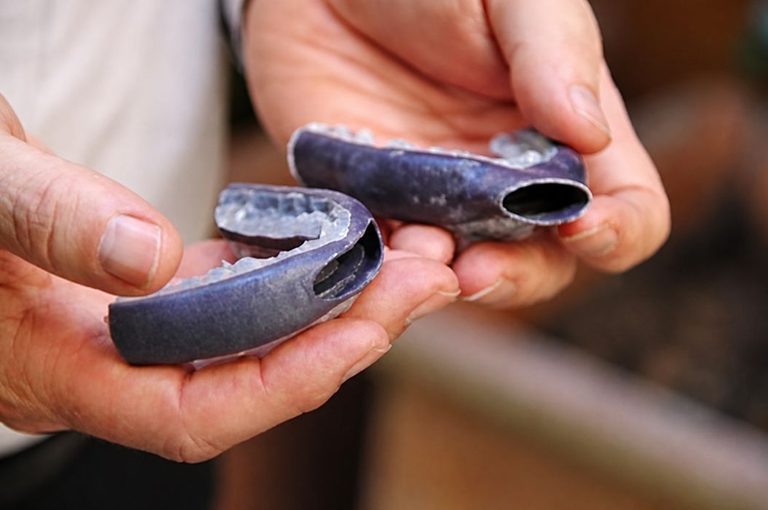Design of the Week: Sleep Apnea Mouthguard